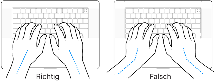 Tastatur und Hände in richtiger und falscher Haltung von Handgelenk und Händen