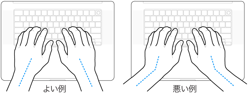 キーボードに置かれた手。手首と手の適切な位置関係と不適切な位置関係を示しています。