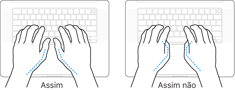 As mãos posicionadas sobre um teclado a mostrar a colocação correta e incorreta dos polegares.