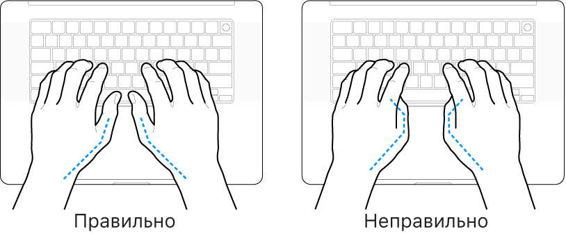 Руки над клавиатурой. Показано правильное и неправильное положение большого пальца.