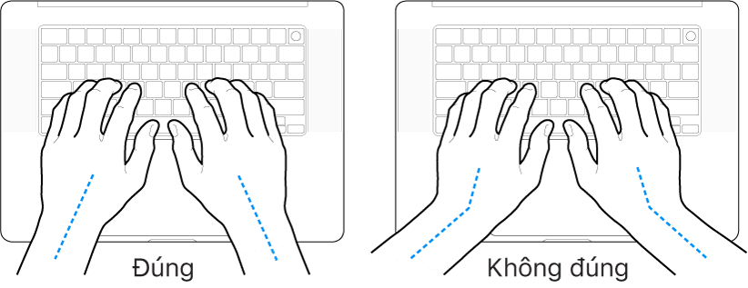 Các bàn tay đặt phía trên bàn phím, minh họa cách đặt cổ tay và bàn tay đúng và sai.