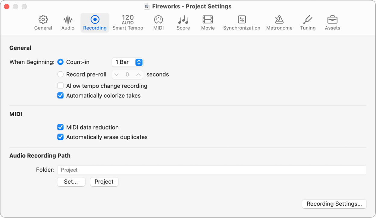 Figure. Recording project settings.