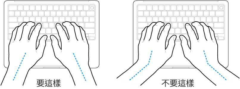雙手置於鍵盤上，分別顯示正確與不正確的手肘與雙手對稱擺放位置。