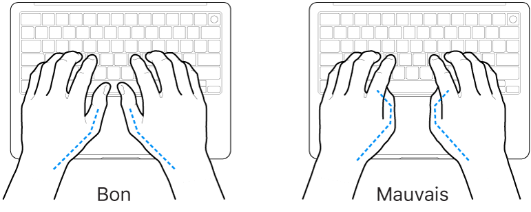 Mains placées sur un clavier, montrant la bonne et la mauvaise position des pouces.