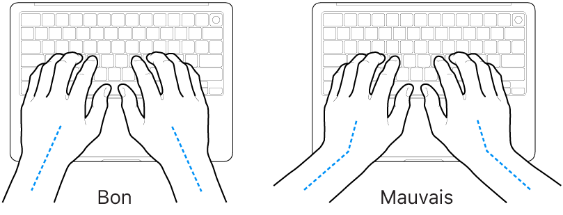 Mains placées sur un clavier, montrant le bon et le mauvais alignement des poignets et des mains.