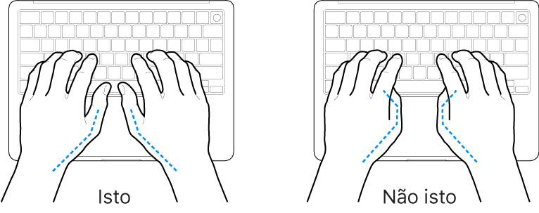 Mãos posicionadas sobre um teclado, mostrando os alinhamentos correto e incorreto dos polegares.