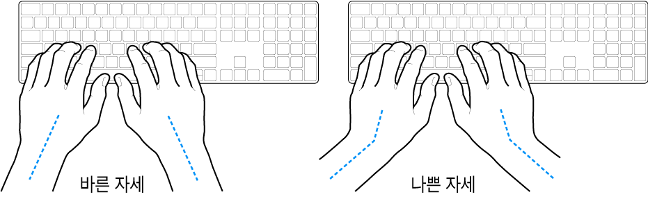 손목 및 손의 바른 자세와 잘못된 자세를 보여주는 키보드 위의 손.