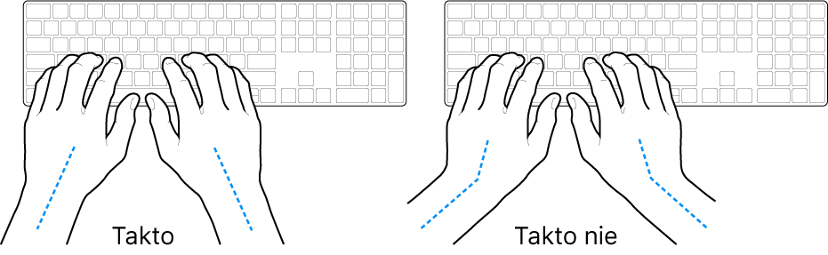Ruky položené na klávesnici znázorňujúce správnu a nesprávnu polohu zápästia a ruky.
