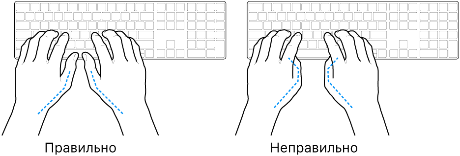 Руки розташовано над клавіатурою й показано правильне та неправильне положення великих пальців.