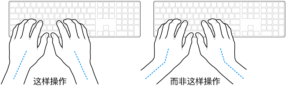 手掌放在键盘上方，显示手腕和手掌的正确对齐位置和错误对齐位置。