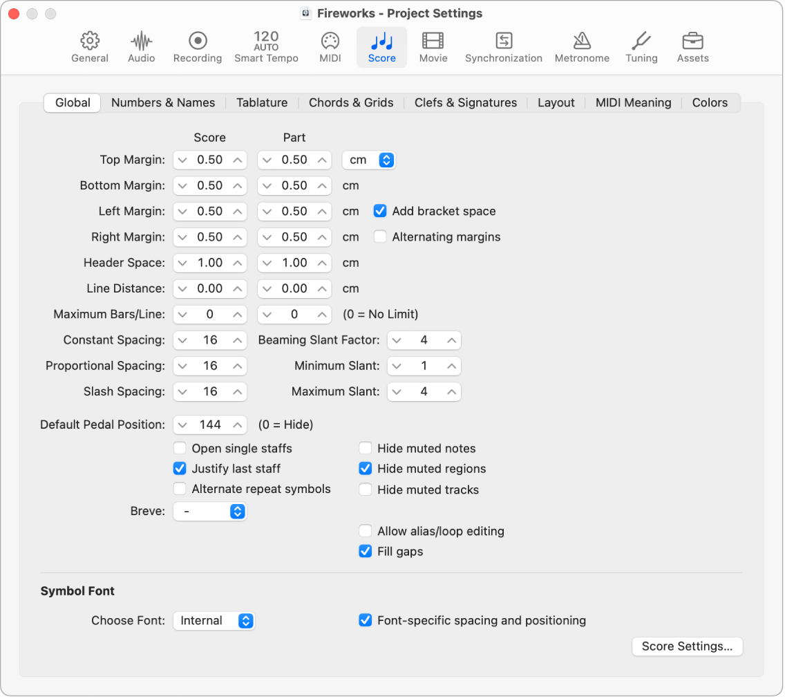 Figure. Global Score project settings.