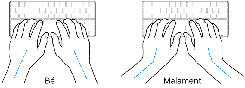 Unes mans posades sobre un teclat mostrant l’alineació correcta i incorrecta del canell i la mà.