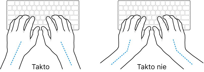 Ruky položené na klávesnici znázorňujúce správnu a nesprávnu polohu zápästia a ruky.