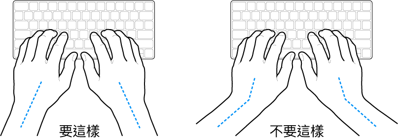 雙手置於鍵盤上，分別顯示正確與不正確的手肘與雙手對稱擺放位置。