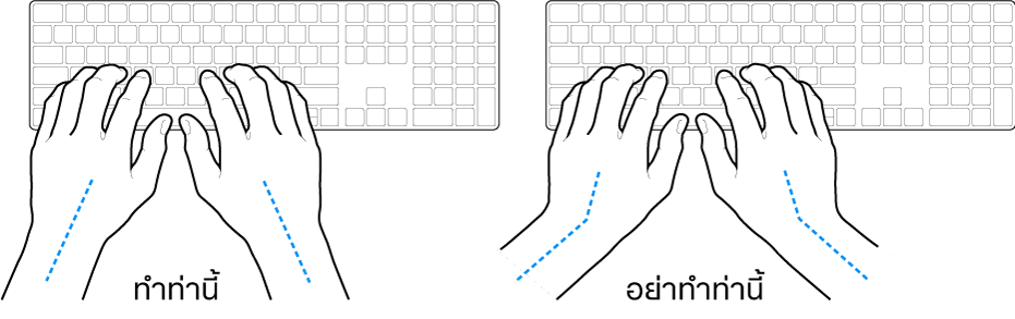 มือวางอยู่เหรือแป้นพิมพ์ แสดงตำแหน่งการวางข้อมือและแขนที่ถูกต้องและไม่ถูกต้อง