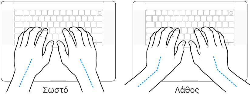 Χέρια τοποθετημένα επάνω σε ένα πληκτρολόγιο, που δείχνουν τη σωστή και τη λανθασμένη θέση των καρπών σε σχέση με τα χέρια.