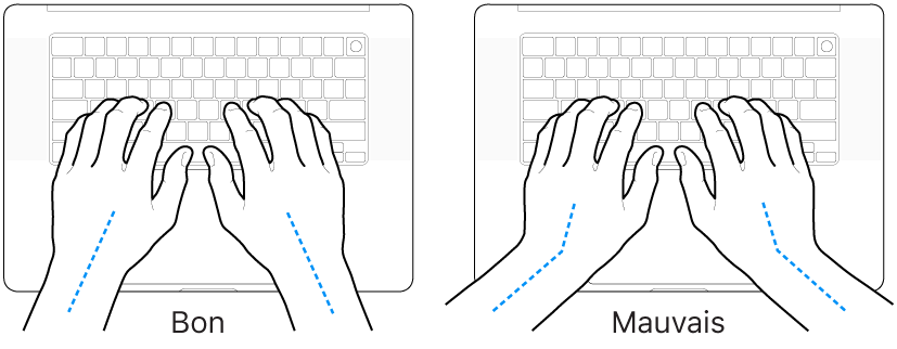 Mains placées sur un clavier, montrant le bon et le mauvais alignement des poignets et des mains.