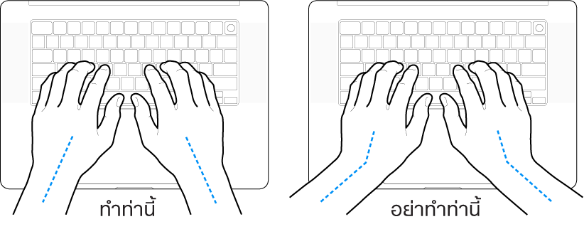 มือวางอยู่เหรือแป้นพิมพ์ แสดงตำแหน่งการวางข้อมือและแขนที่ถูกต้องและไม่ถูกต้อง