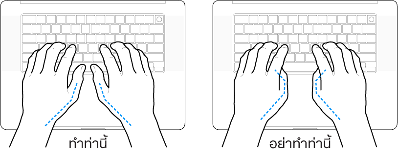 มือวางอยู่เหรือแป้นพิมพ์ แสดงตำแหน่งการวางนิ้วหัวแม่มือที่ถูกต้องและไม่ถูกต้อง