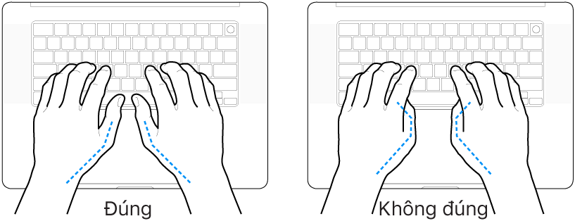 Các bàn tay đặt phía trên bàn phím, minh họa cách đặt ngón cái đúng và sai.
