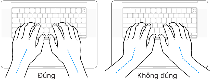 Các bàn tay đặt phía trên bàn phím, minh họa cách đặt cổ tay và bàn tay đúng và sai.