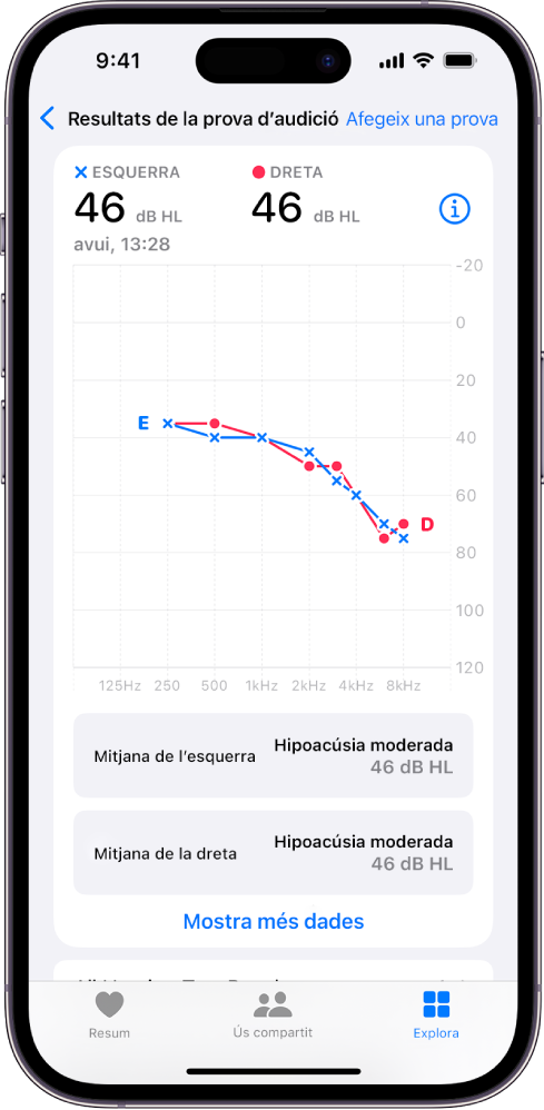 Un audiograma a l’iPhone en què es veu una pèrdua d’audició moderada a totes dues orelles.