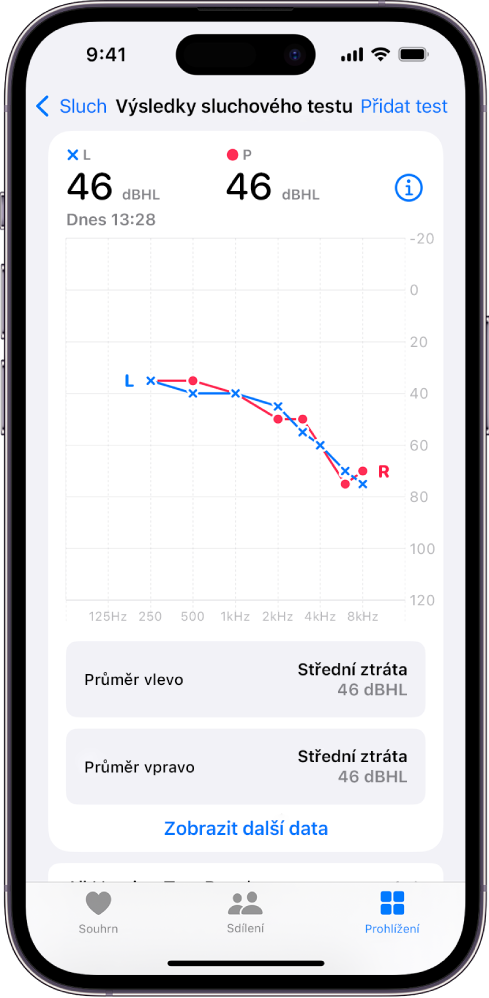 Audiogram na iPhonu ukazující na středně těžké poškození sluchu u obou uší