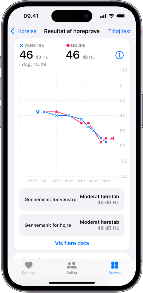 Et audiogram på iPhone, der viser moderat høretab på begge ører.