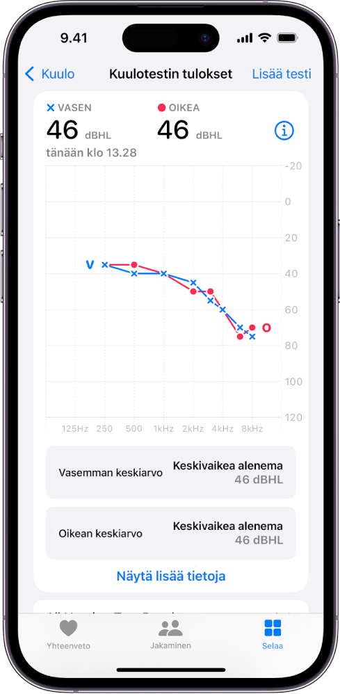 iPhonessa näkyvä kuulokäyrä osoittaa keskivaikean kuulonaleneman molemmissa korvissa.