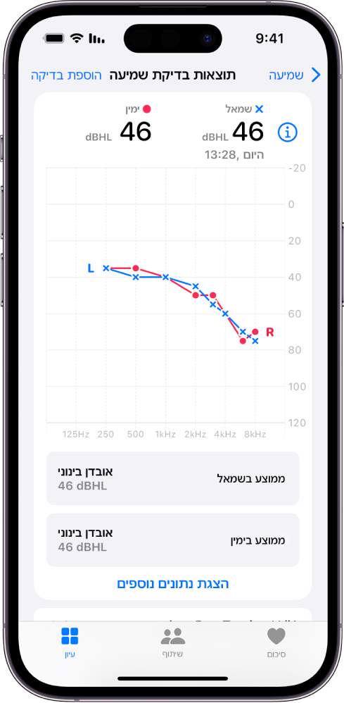 אודיוגרמה ב‑iPhone המתארת אובדן שמיעה בינוני בשתי האוזניים.