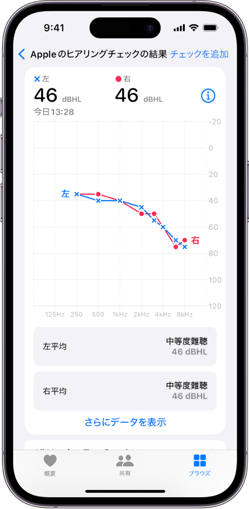 iPhoneのオージオグラム。両耳に中等度の難聴があることが示されています。