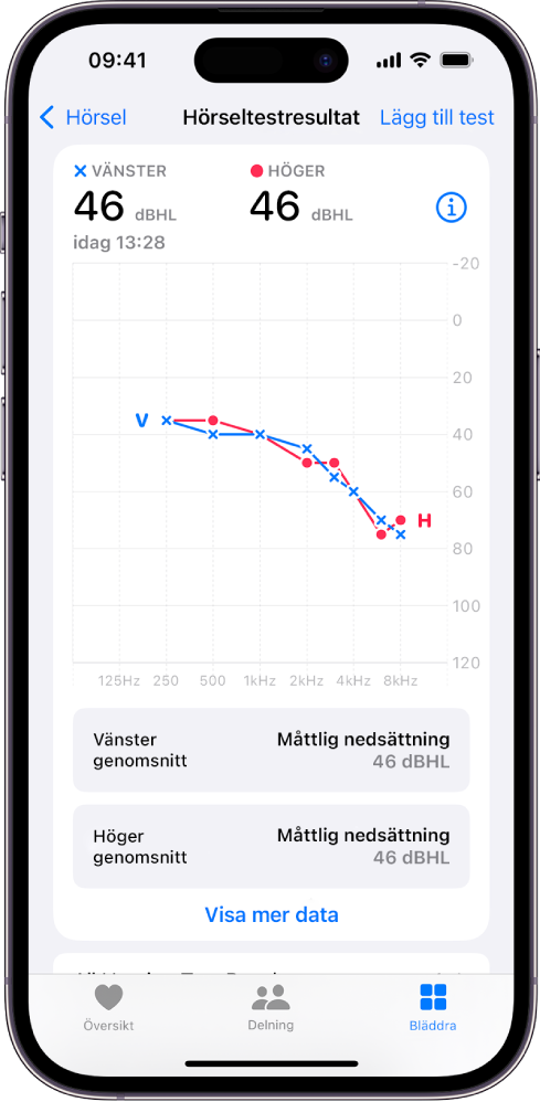 Ett audiogram på iPhone visar en måttlig hörselnedsättning i båda öronen.