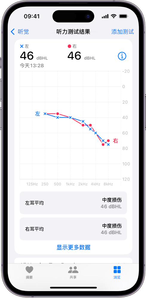 iPhone 上的听力图，显示双耳均有中度听力损伤。