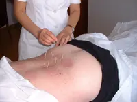 Acupuncture SinoSanté Morges – Cliquez pour agrandir l’image 2 dans une Lightbox