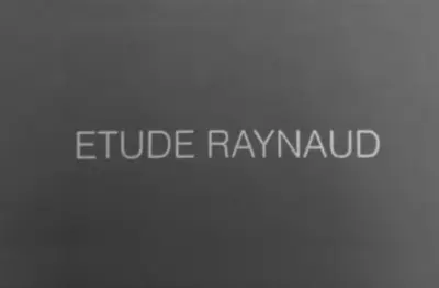 Etude Raynaud