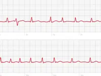 Cardio-Rhythm SA – Cliquez pour agrandir l’image 5 dans une Lightbox