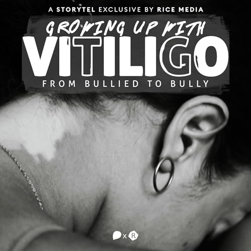 Growing Up with Vitiligo, I Was Bullied—Until I Became a Bully cover art