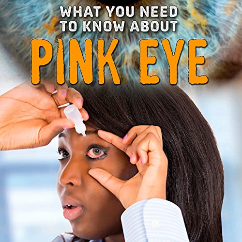 What You Need to Know About Pink Eye cover art