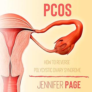 PCOS Audiobook By Jennifer Page cover art