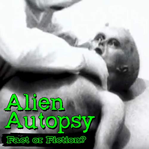 Page de couverture de Alien Autopsy: Fact or Fiction?