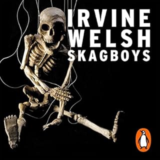 Skagboys Audiobook By Irvine Welsh cover art