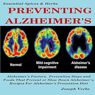 Preventing Alzheimer's Audiobook By Joseph Veebe cover art