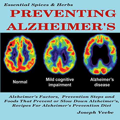 Preventing Alzheimer's Audiobook By Joseph Veebe cover art