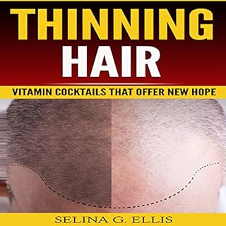 Thinning Hair: Vitamin Cocktails That Offer New Hope Audiolibro Por Selina G. Ellis arte de portada