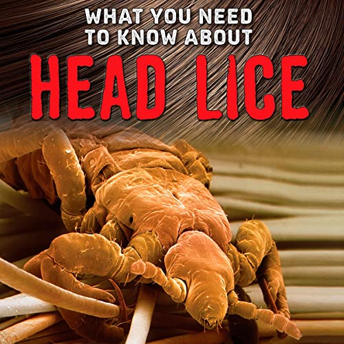 What You Need to Know About Head Lice cover art