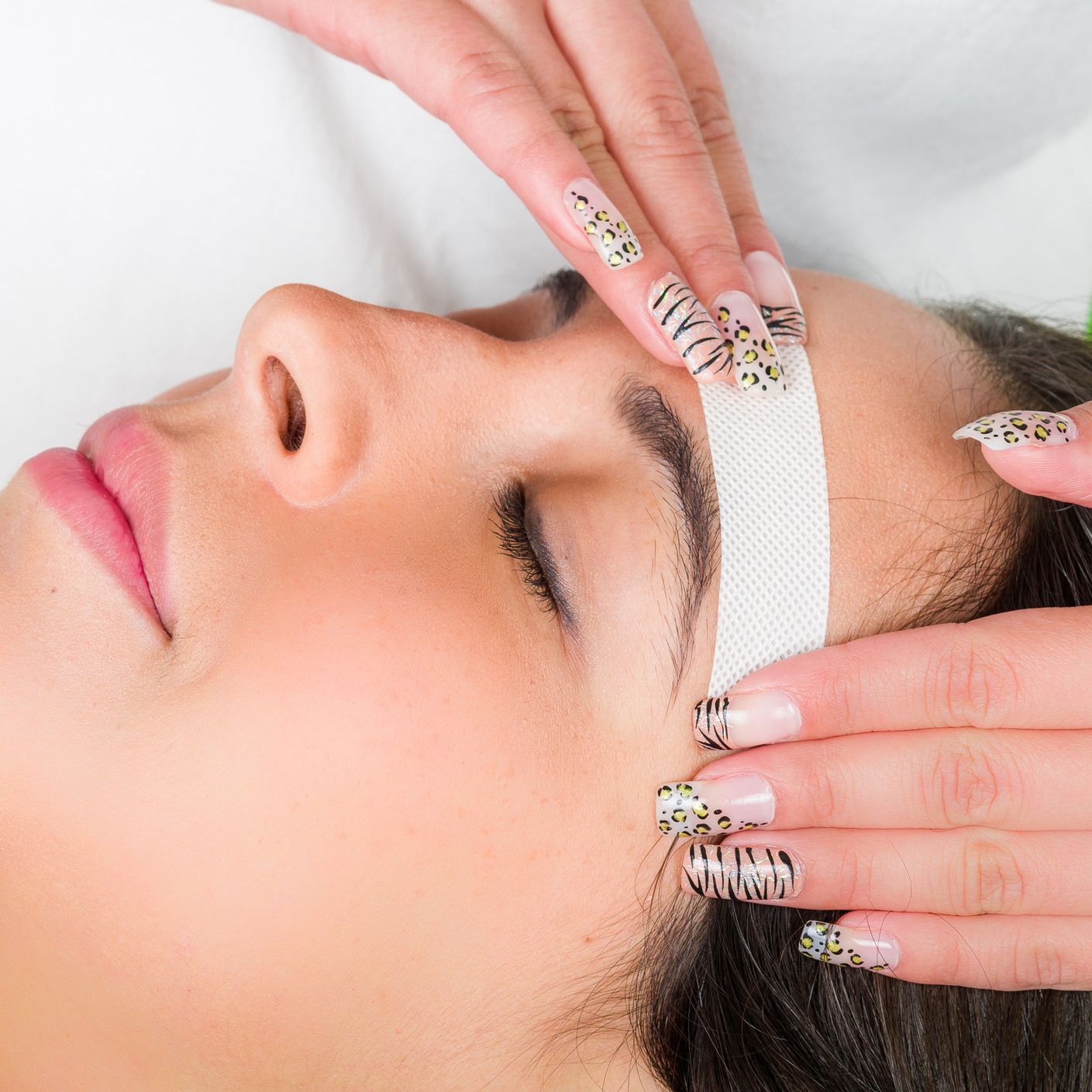 MICRODERMABRASION TREATMENTS