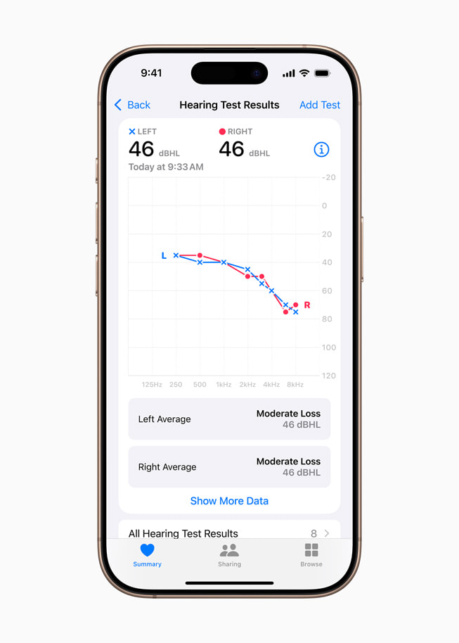 The results from a Hearing Test displayed in the Health app on iPhone 16 Pro.