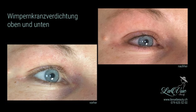 Wimpernkranzverdichtung oben und unten Vorher Nachher Bild MICRONEEDLING PERMANENT MAKE UP MICROBLADING THUN BERN