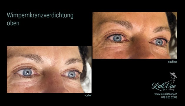 Wimpernkranzverdichtung oben Vorher Nachher Bild MICRONEEDLING PERMANENT MAKE UP MICROBLADING THUN BERN