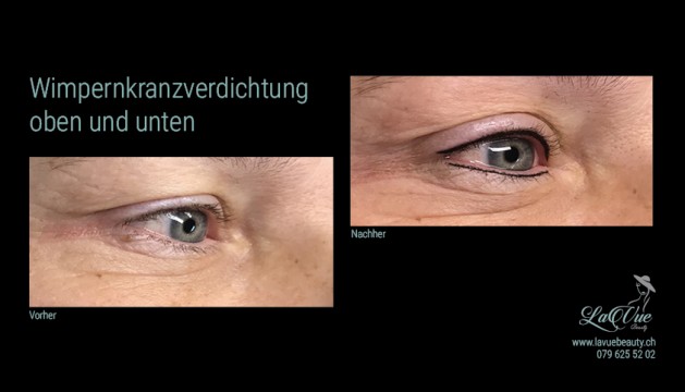 Wimpernkranzverdichtung oben und unten Vorher Nachher Bild MICRONEEDLING PERMANENT MAKE UP MICROBLADING THUN BERN